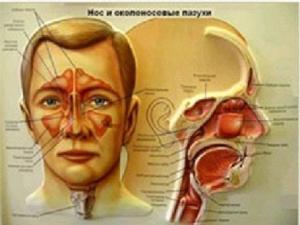 Лечение гайморита в Новороссийске ГАЙМОРИТ нос! бол.бол..jpg